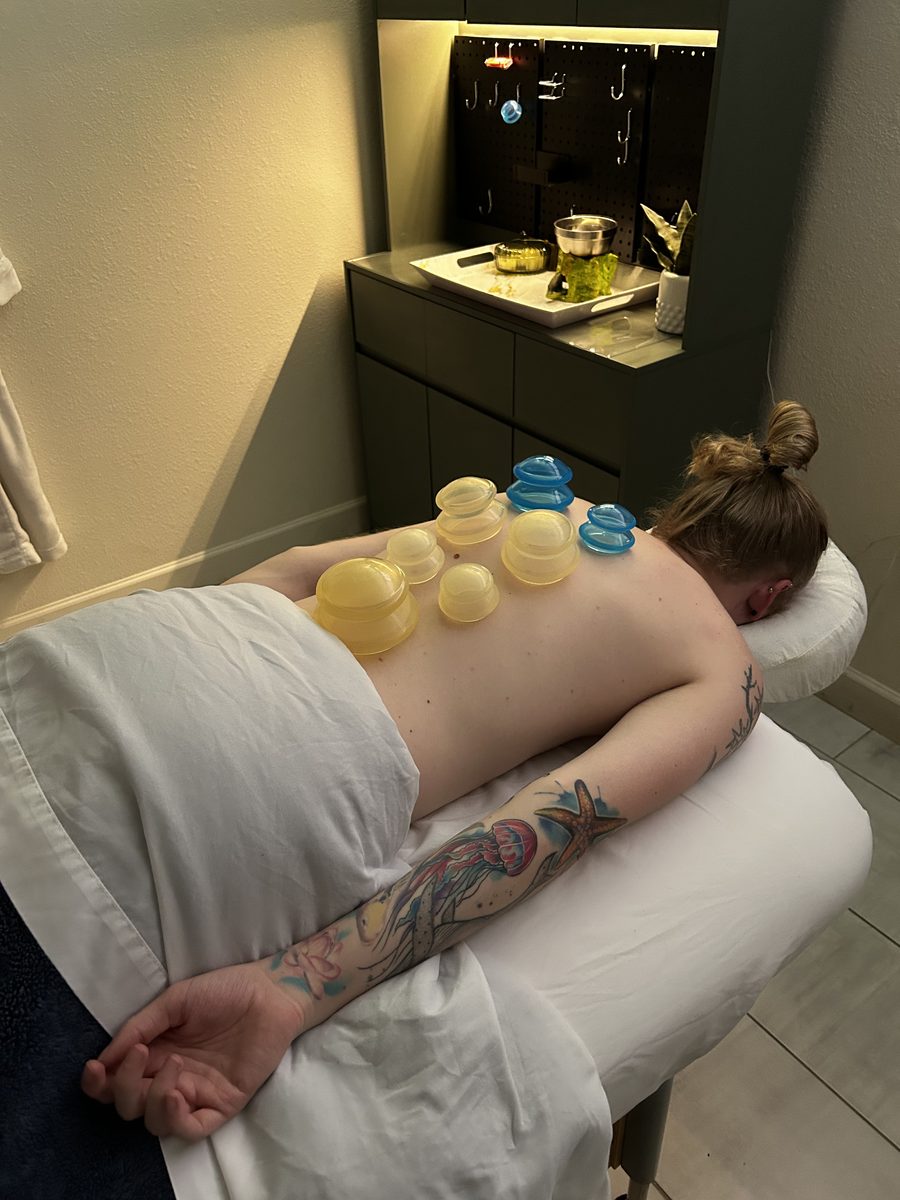 Restorative cupping at Awaken Zen Spa in Mesa, AZ